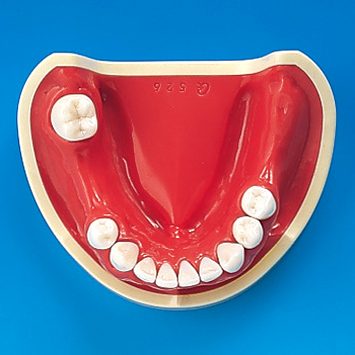 2色レジン製顎模型 [E50-各種]｜株式会社ニッシン｜歯科模型・歯科材料 