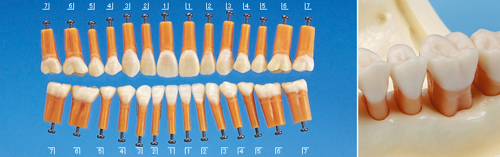 SRP実習用顎模型 [P15FE-MINT.1]｜株式会社ニッシン｜歯科模型・歯科